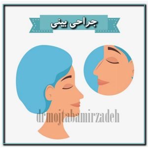 جراحی بینی - دکتر میرزاده