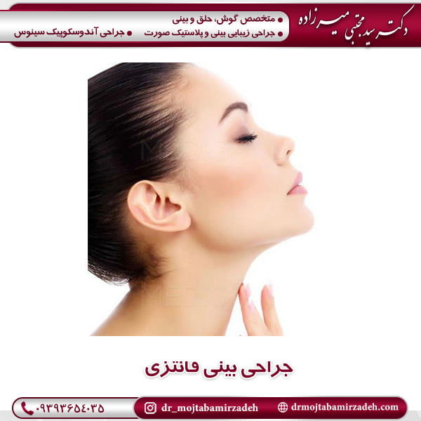 جراحی بینی فانتزی - دکتر مجتبی میرزاده