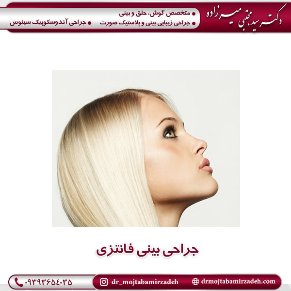 جراحی بینی فانتزی - دکتر میرزاده