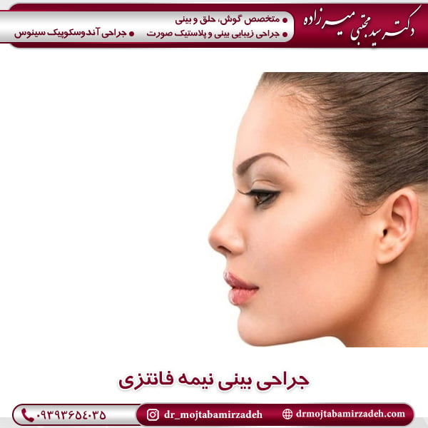 جراحی بینی نیمه فانتزی