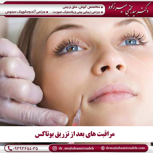مراقبت های بعد از تزریق بوتاکس