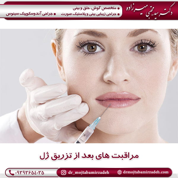 مراقبت های بعد از تزریق ژل