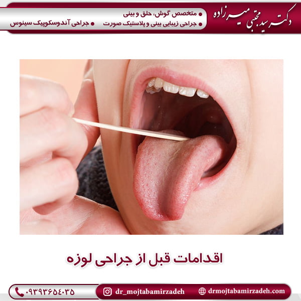 اقدامات قبل از جراحی لوزه