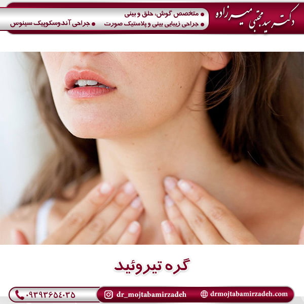 گره تیروئید