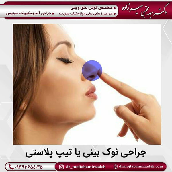 تیپ پلاستی