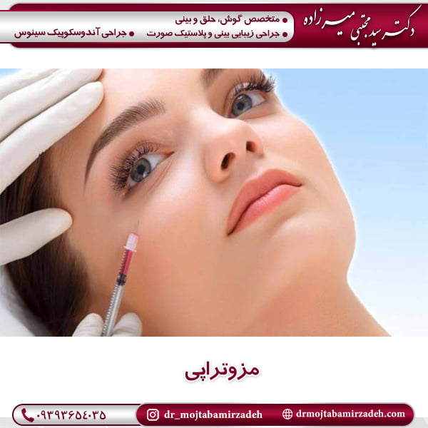 مزوتراپی - دکتر میرزاده