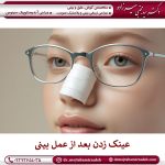 امکان استفاده از عینک بعد عمل بینی وجود دارد؟