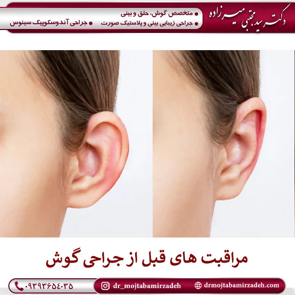 مراقبت های مهم و ضروری قبل از عمل گوش