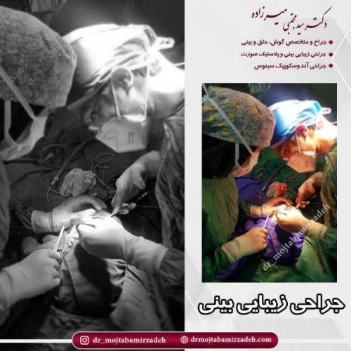 جراحی-بینی-38
