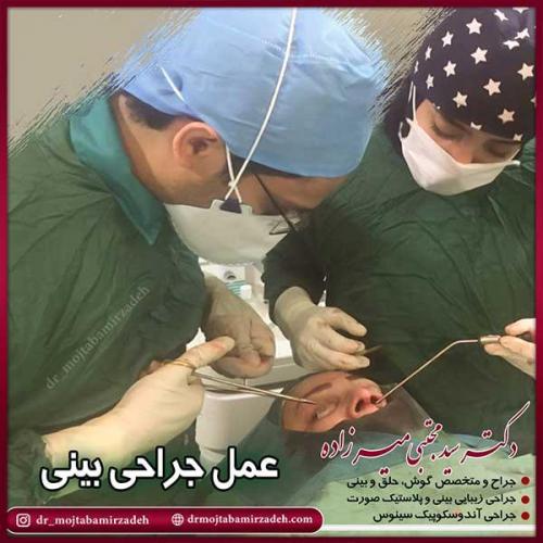 جراحی-بینی-40