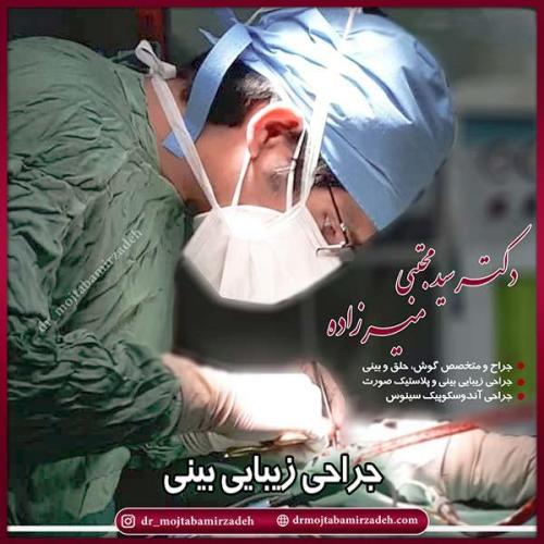 جراحی-بینی-45