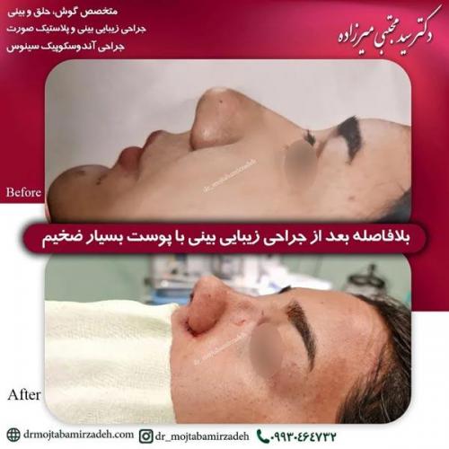 جراحی-بینی-یزد204