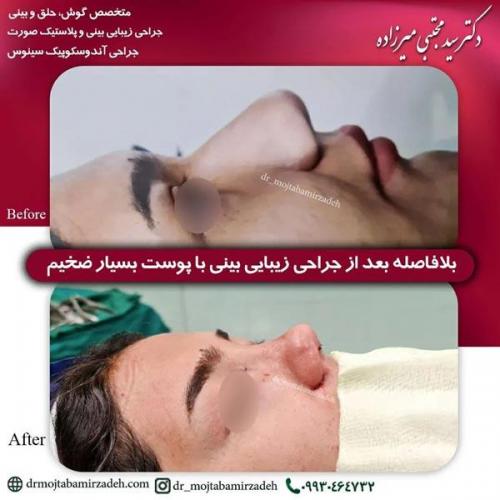 جراحی-بینی-یزد205
