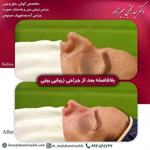 جراحی-بینی-یزد207