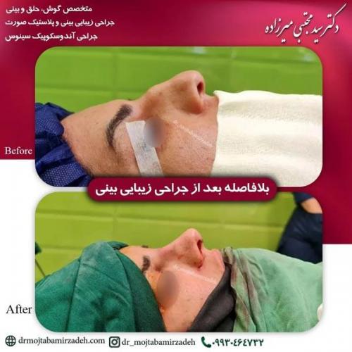 جراحی-بینی-یزد227