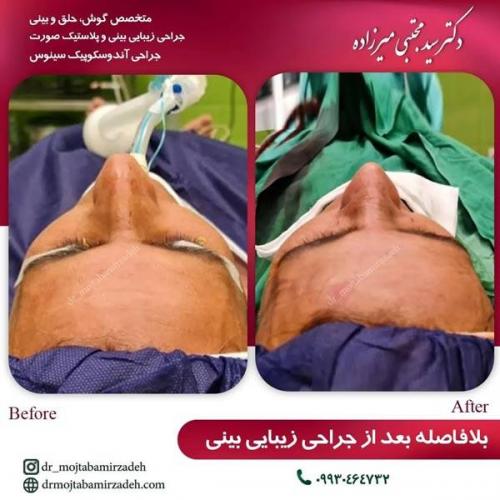 جراحی-بینی-یزد229