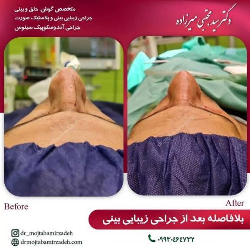 جراحی-بینی-یزد232