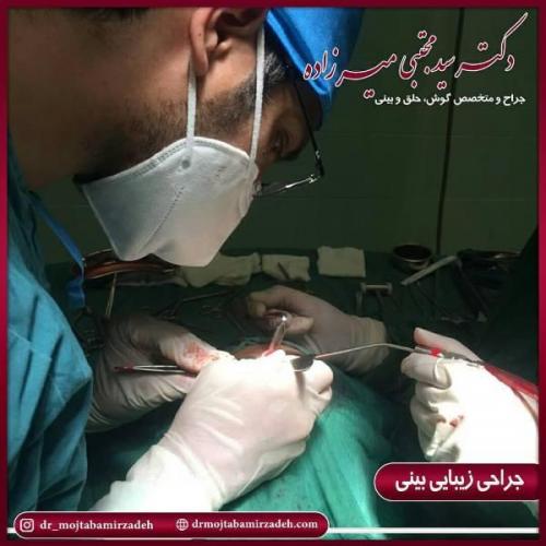 جراحی بینی 54 (12)