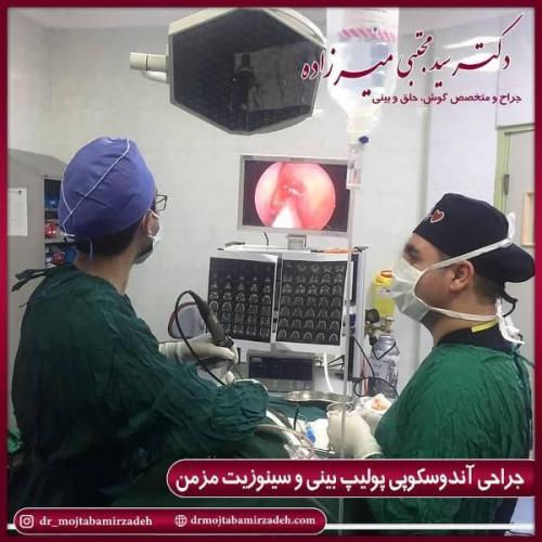 جراحی بینی 54 (2)