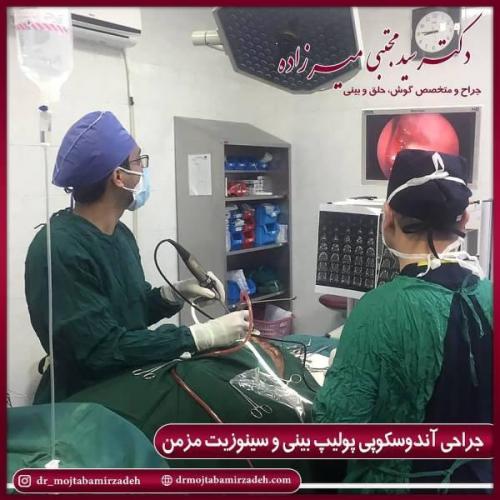 جراحی بینی 54 (3)