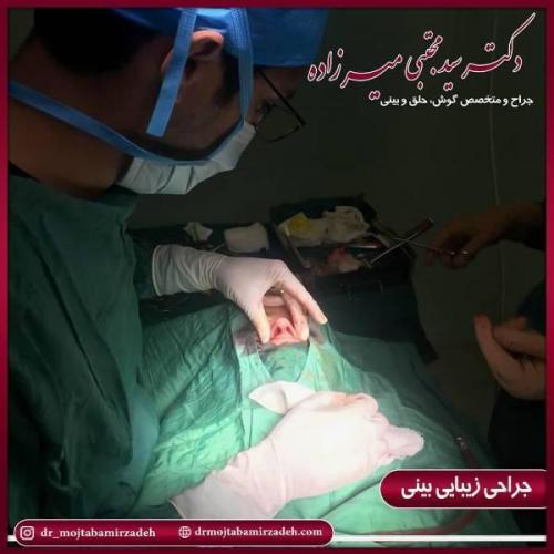 جراحی بینی 54 (5)